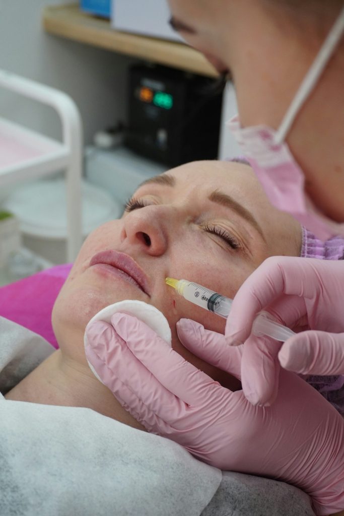 A woman getting dermal fillers in her cheeks